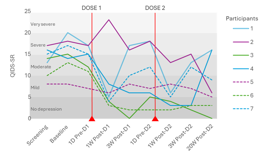 Line graph depicting individual trajectories of QIDS-SR (Quick Inventory of Depressive Symptomatology - Self-Report) scores for seven participants across various time points. The y-axis represents QIDS-SR scores, ranging from 0 ('No depression') to 25 ('Very severe depression'), while the x-axis marks time points: Screening, Baseline, 1 day pre-dose 1, 1 week post-dose 1, 3 weeks post-dose 1, 1 day pre-dose 2, 1 week post-dose 2, 3 weeks post-dose 2, and 20 weeks post-dose 2. Each participant's score is represented by a distinct line and colour. Red vertical lines highlight the timing of Dose 1 and Dose 2. Scores generally show a decline after dosing, reflecting potential reductions in depression severity, though variability in response is evident across participants. Two participants, indicated by green lines, showed a sustained response with consistently low QIDS-SR scores following treatment. Three participants, indicated by blue lines, relapsed, showing an initial reduction in scores followed by an increase. Two participants, indicated by purple lines, showed no substantial reduction in depression during the treatment.